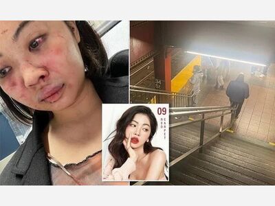 MANHATTAN: NYC model ‘lucky to be alive’ after being put in chokehold, punched in face, robbed by subway mugger